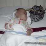 Mukti in the pediatric ward, right after the operation.